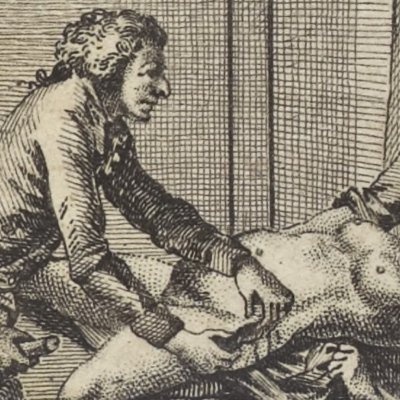 Bandole et la parturiente (Nlle Justine, 1799, ch7, fig11)