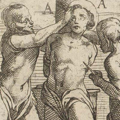 Peau du visage arrachée (Tratt. de gli instr. di martirio, 1591) - G. Guerra
