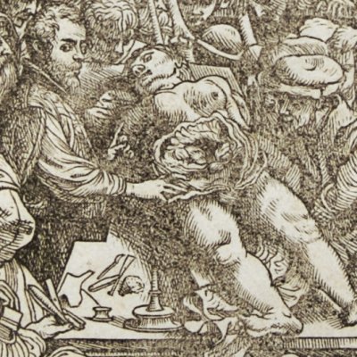 Leçon d’anatomie (André Vésale, De humani corporis fabrica, Bâle, 1543)