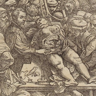 Leçon d’anatomie (André Vésale, De humani corporis fabrica, Bâle, 1543, frontispice)