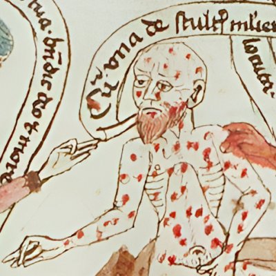 Job maltraité par Satan et par sa femme (Speculum humanæ salvationis 10B34)