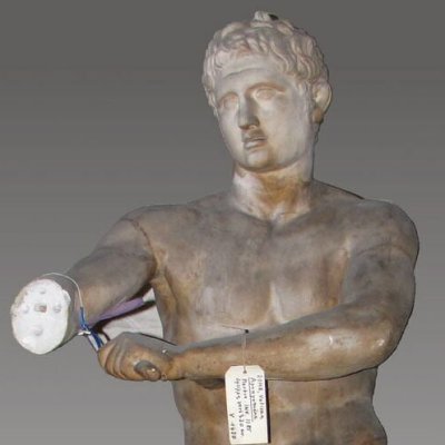Apoxyomène (moulage du Louvre) - d'après Lysippe